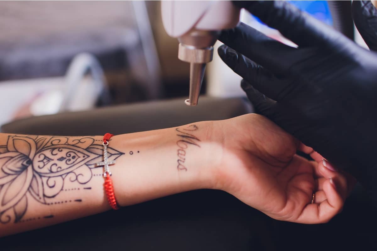 Mon tatouage a mal vieilli : quelle est la solution ? | Clinique Bellefontaine | Lausanne